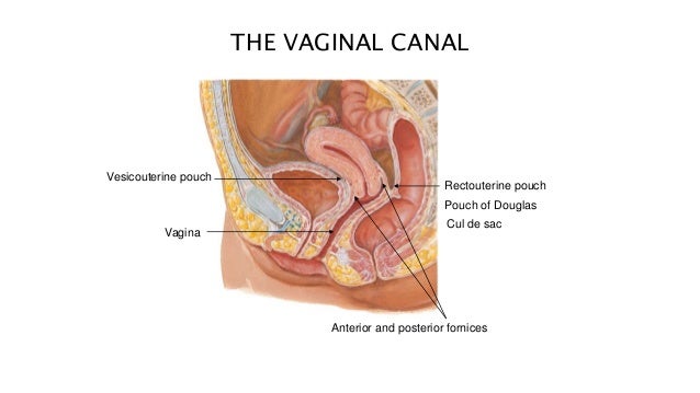 cul de sac vagina diagram What does a smelly vagina mean